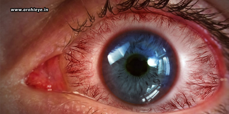 The Most Common Retinal Diseases