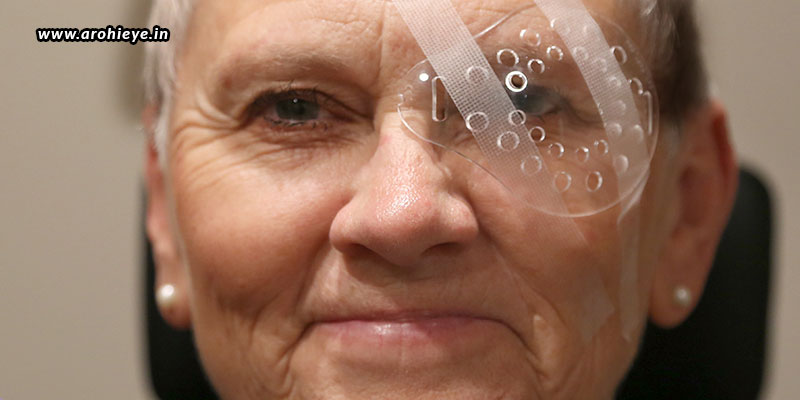 eye shield after cataract surgery