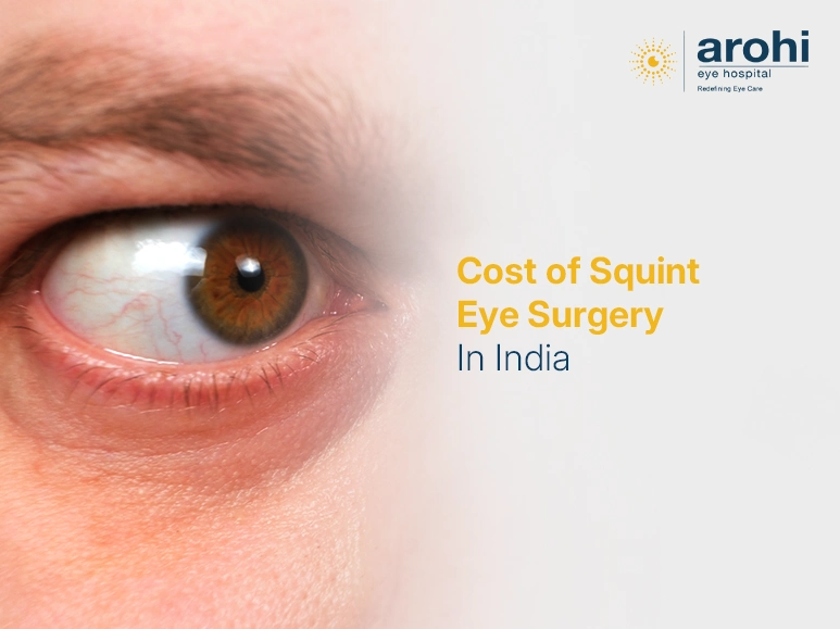 Cost-Of-Squint-Eye-Surgery-In-India