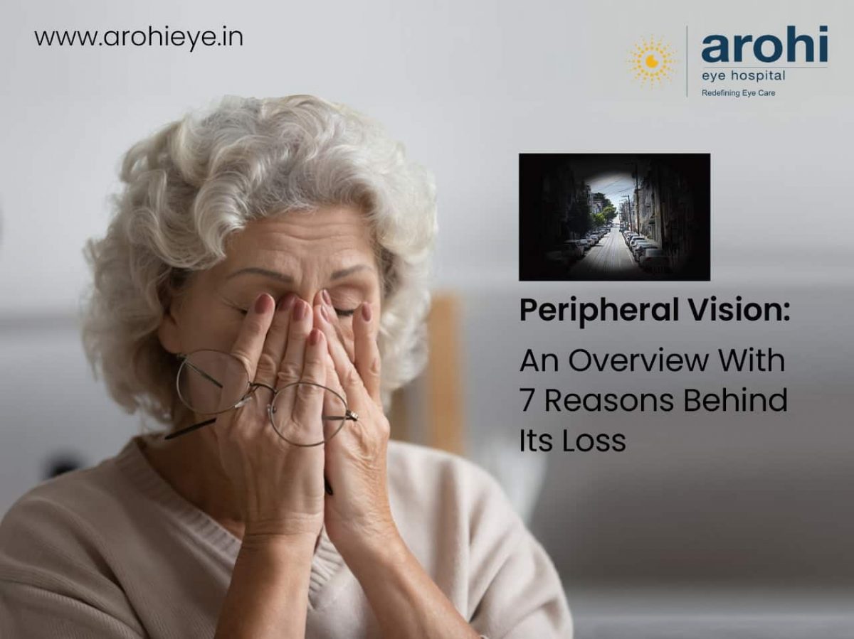 Tunnel Vision (Peripheral Vision Loss): Symptoms, Causes, Treatments