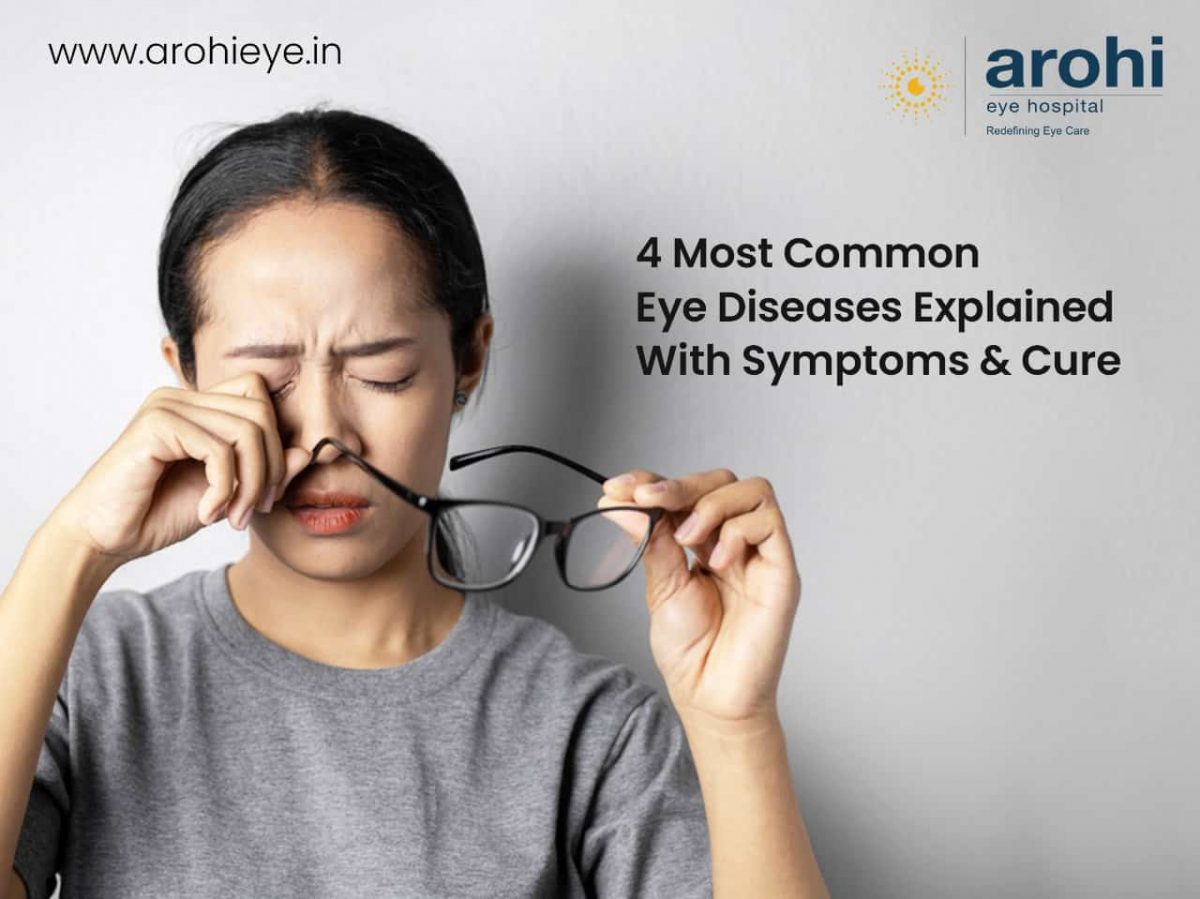 Common eye diseases explained with symptoms and cure