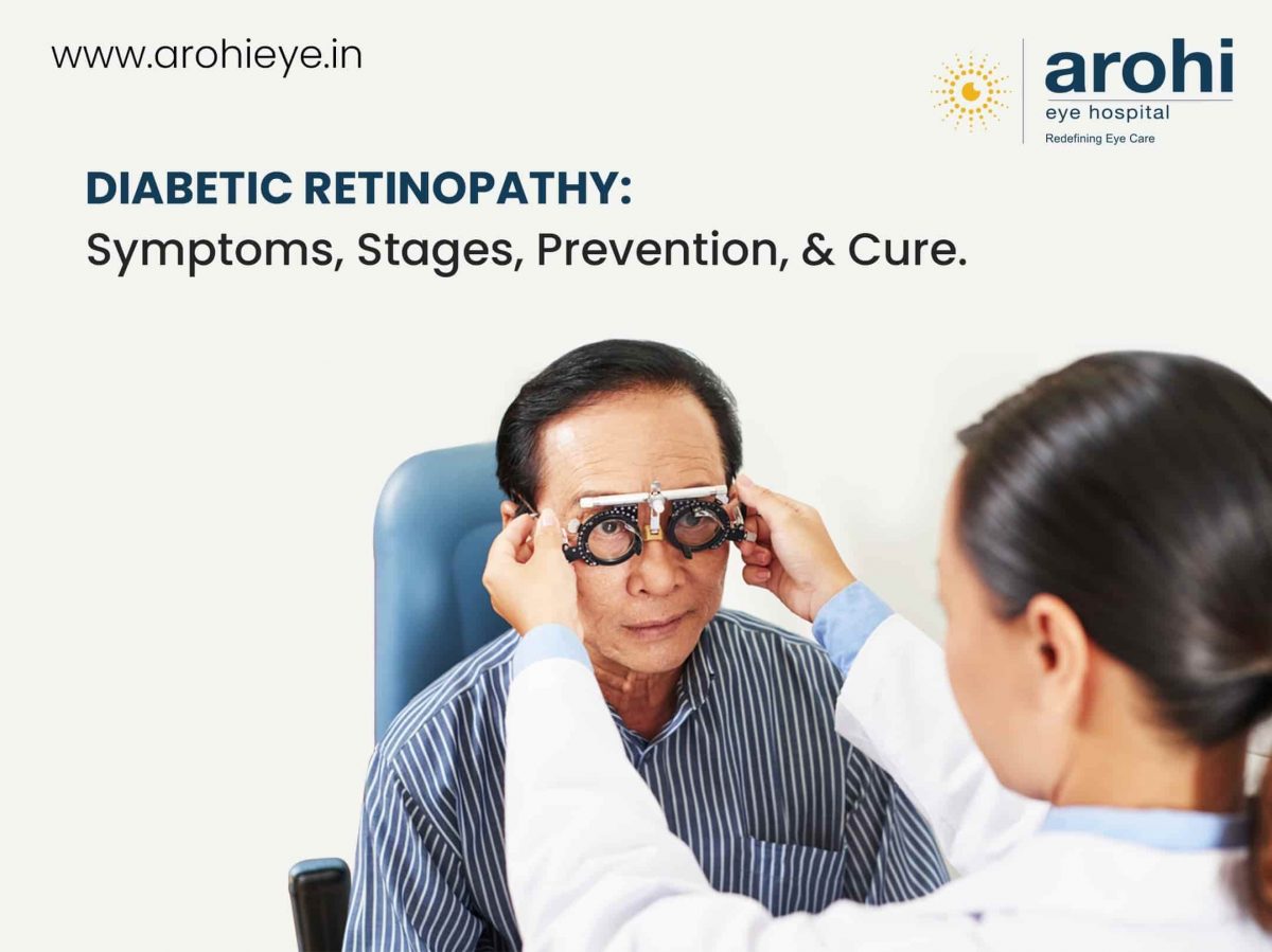 Diabetic Retinopathy Stages