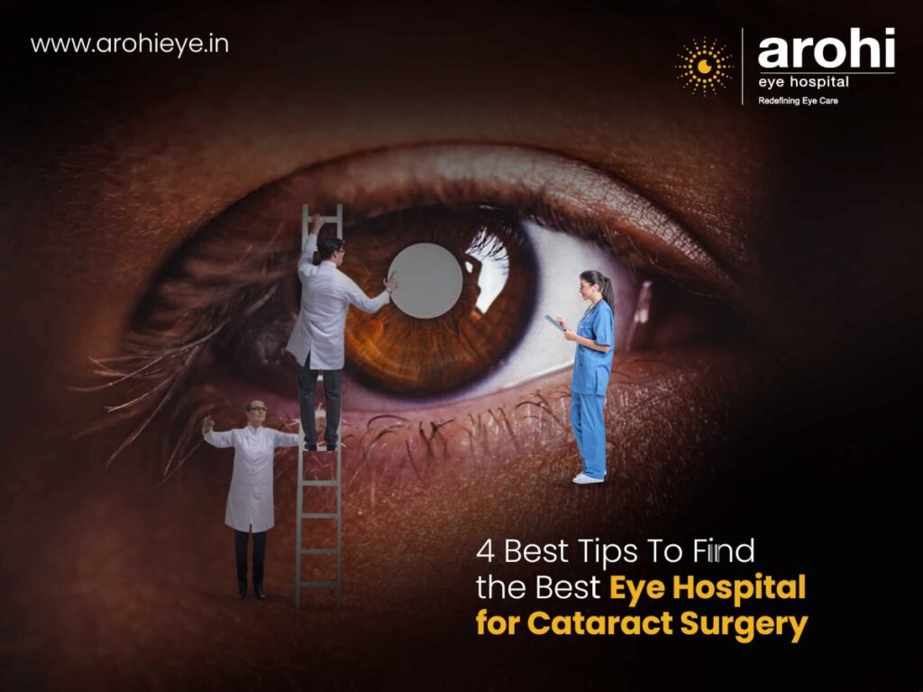 4 Best Tips To Find the Best Eye Hospital for Cataract Surgery