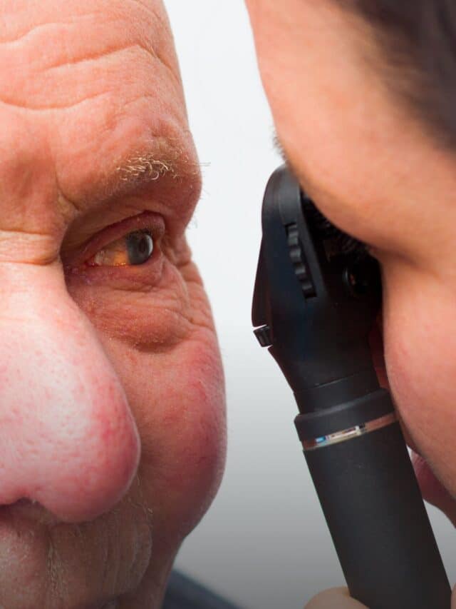 symptoms of cataract