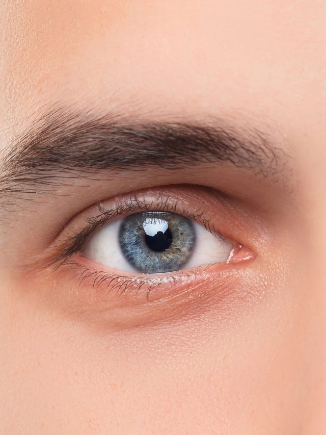 cataract