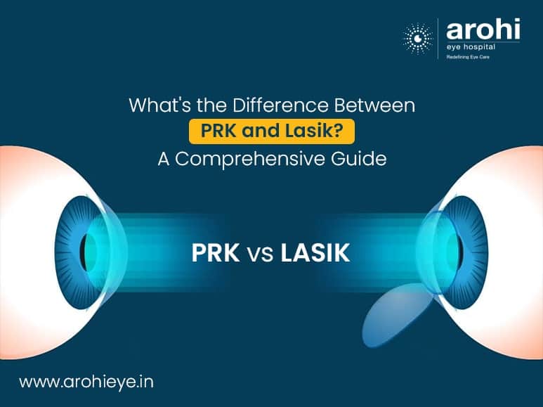 PRK vs. LASIK