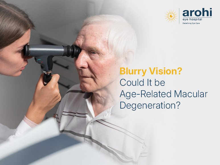 Age-Related Macular Degeneration