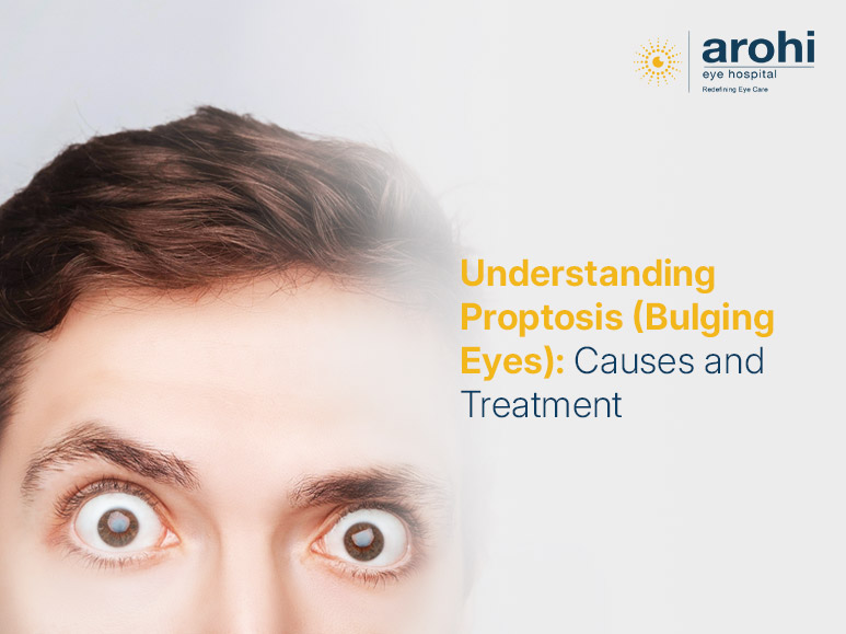 proptosis symptoms