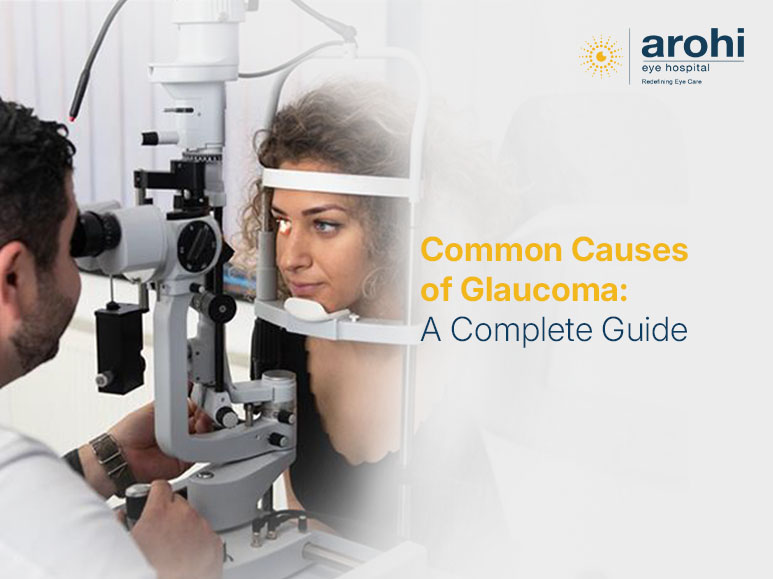 Causes of glaucoma