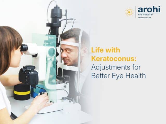 Life with Keratoconus: Adjustments for Better Eye Health