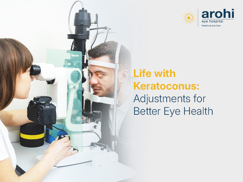 Keratoconus diagnosis