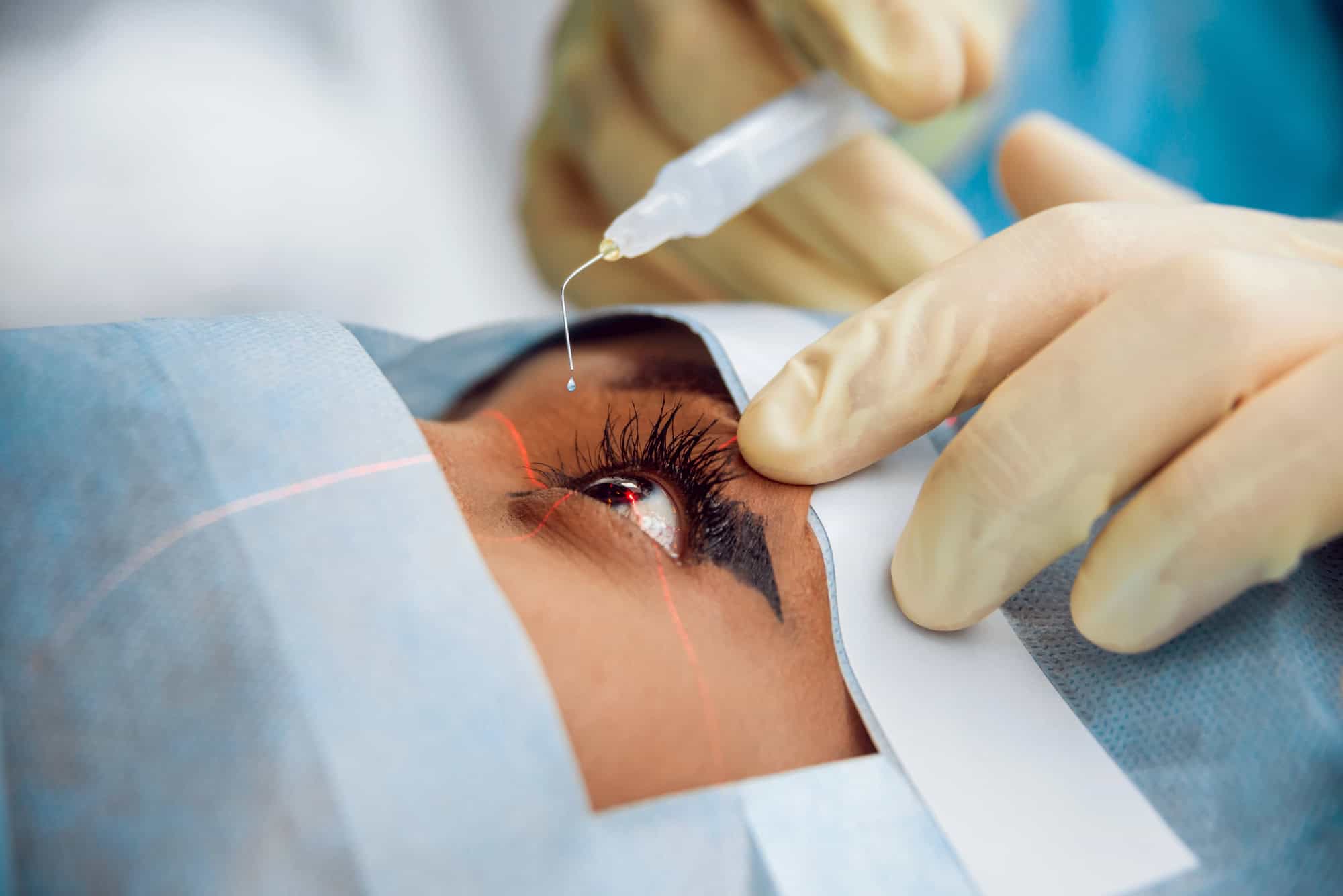 lasik cost in india