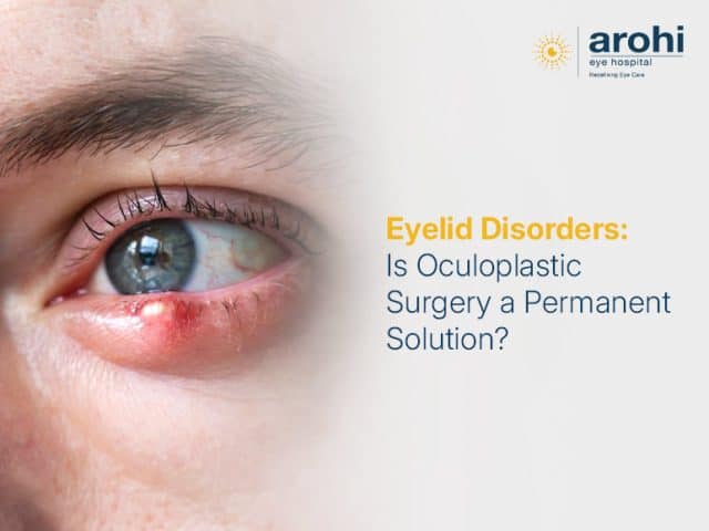Eyelid Disorders: Is Oculoplastic Surgery a Permanent Solution?