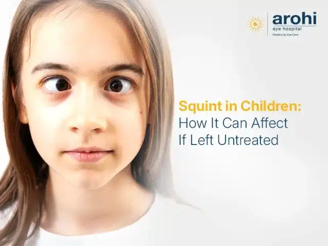 Squint in Children: How It Can Affect If Left Untreated