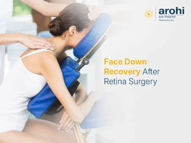 Face Down Recovery After Retina Surgery