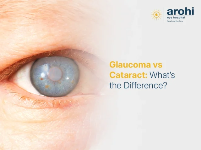 Glaucoma vs Cataract: What’s the Difference?