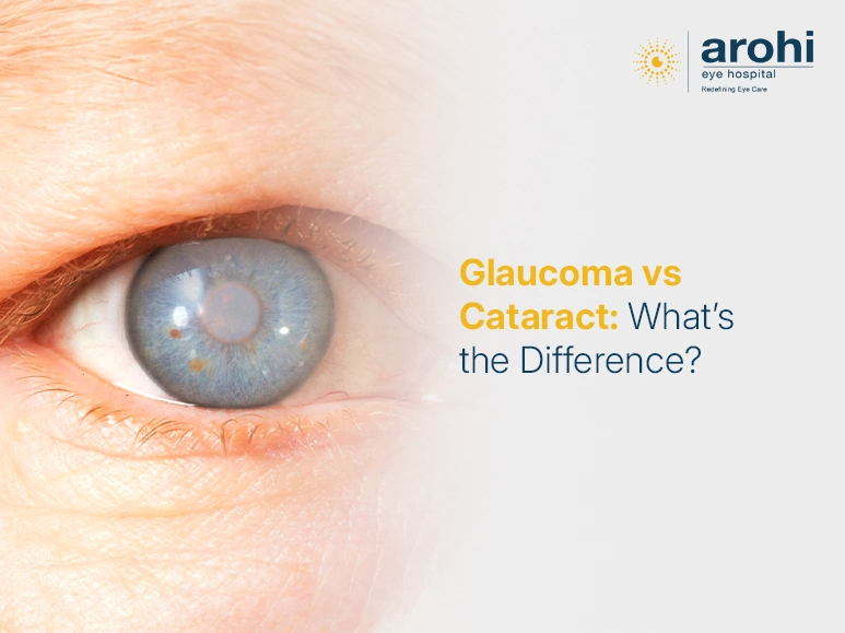 Glaucoma and Cataract difference