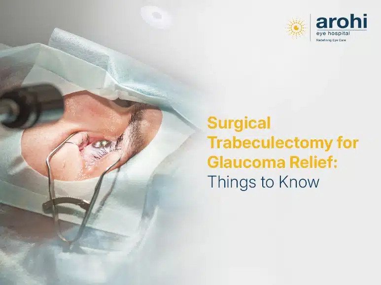 trabeculectomy surgery for glaucoma