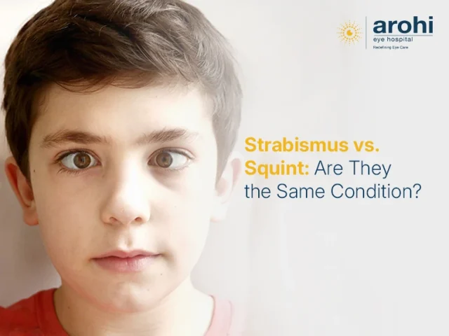 Strabismus vs. Squint: Are They the Same Condition?