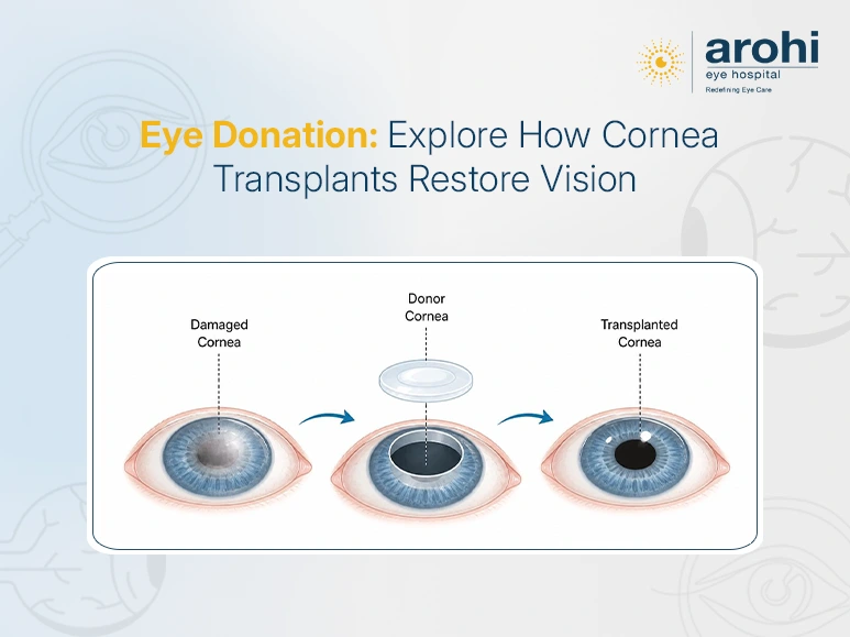 Awareness about eye donation and corneal blindness treatment