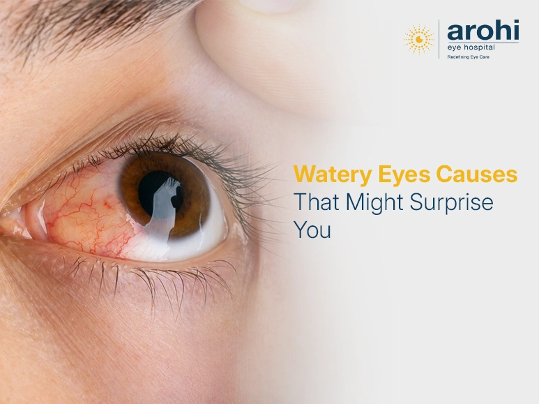 Watery Eyes Causes