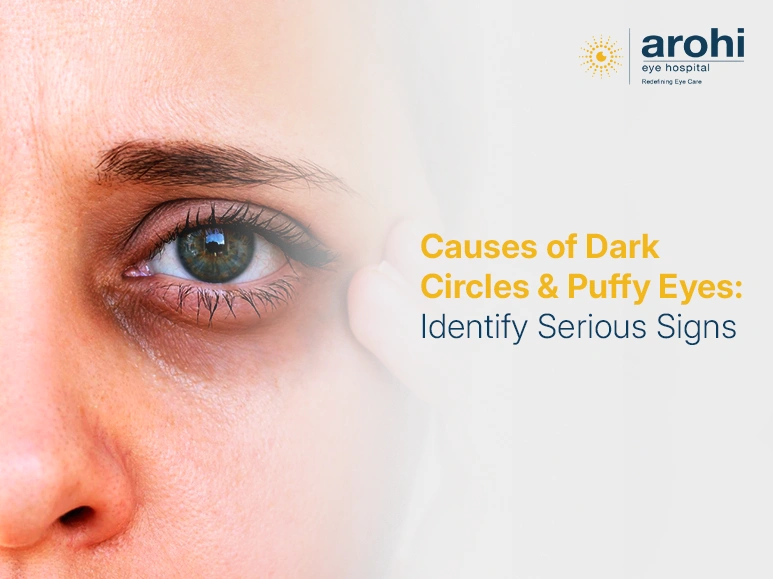 Causes of Dark Circles & Puffy Eyes